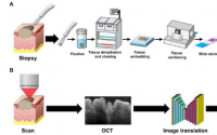 虚拟活检让临床医生能够无创地分析皮肤