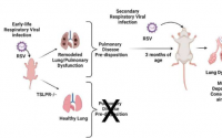两岁前感染 RSV 可导致长期肺部变化和损伤