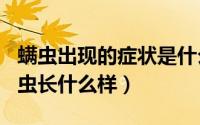 螨虫出现的症状是什么（2024年05月29日螨虫长什么样）