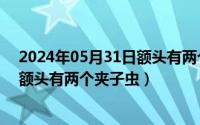 2024年05月31日额头有两个夹子虫吗（2024年05月31日额头有两个夹子虫）