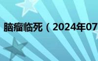 脑瘤临死（2024年07月16日脑瘤死前症状）