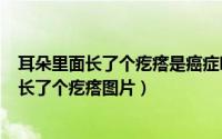 耳朵里面长了个疙瘩是癌症吗（2024年07月26日耳朵里面长了个疙瘩图片）