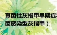 真菌性灰指甲早期症状（2024年08月19日真菌感染型灰指甲）