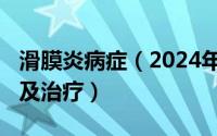 滑膜炎病症（2024年08月29日滑膜炎的症状及治疗）