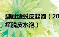 脚趾缝蜕皮起泡（2024年09月08日脚趾缝发痒脱皮水泡）