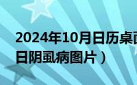 2024年10月日历桌面壁纸（2024年10月02日阴虱病图片）