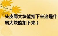 头皮屑大块能扣下来这是什么原因（2024年10月09日头皮屑大块能扣下来）